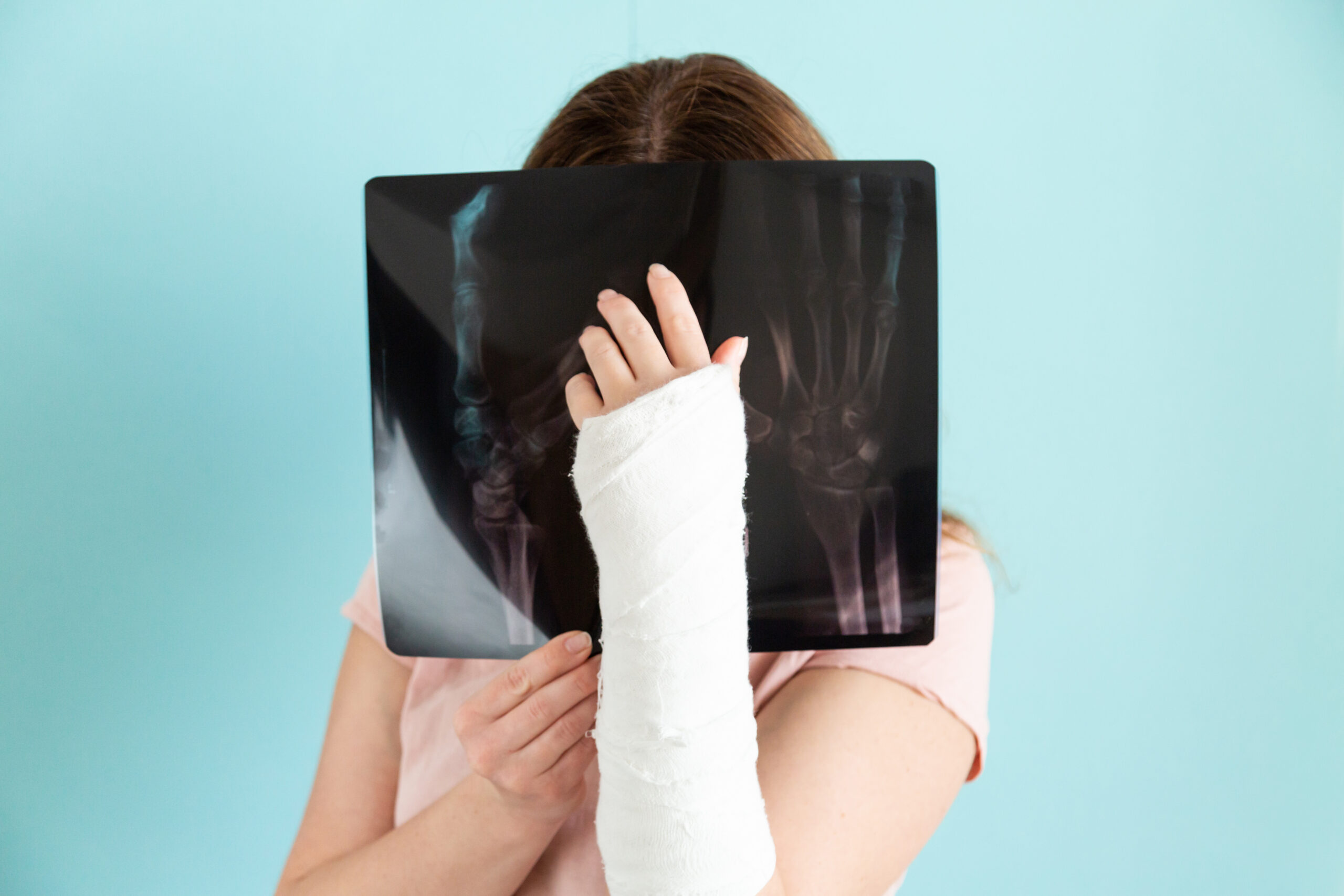 woman holding x ray with arm cast against background fracture first aid